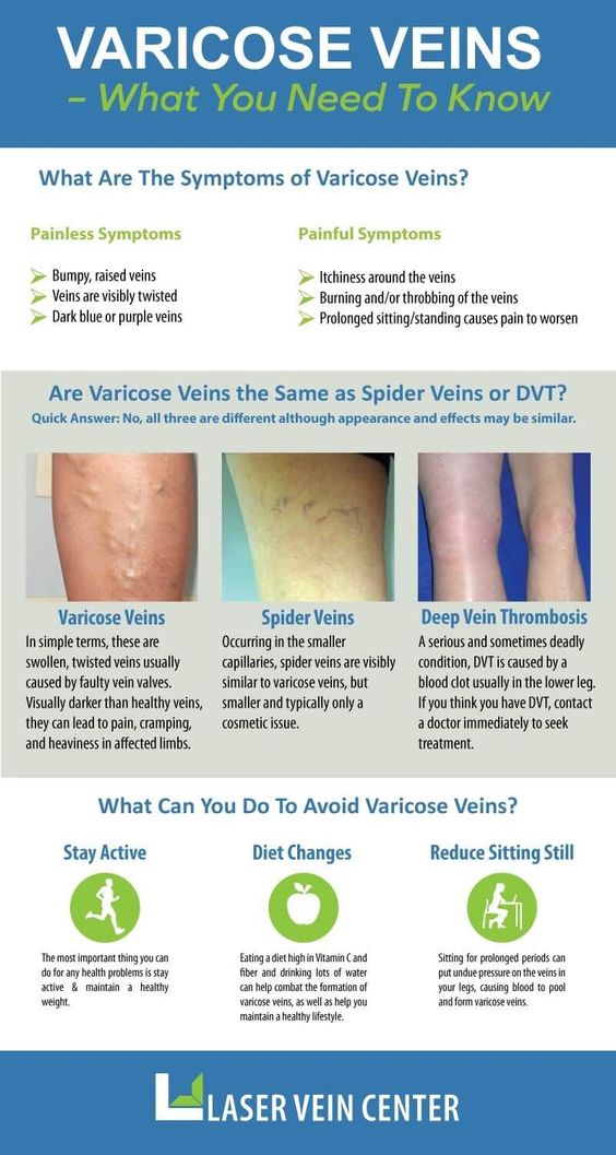 Varicose Veins: Understanding and Care for Healthy Legs.