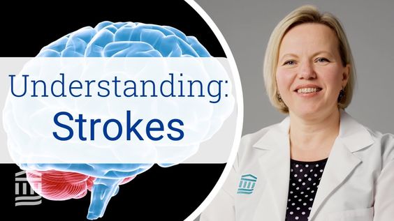 Understanding Stroke: Causes, Symptoms, and Treatment Options.