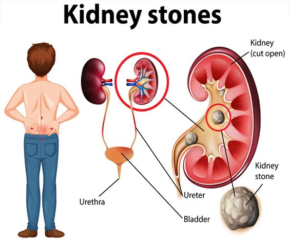 The Ultimate Guide to Kidney Care: Maintaining Health and Vitality